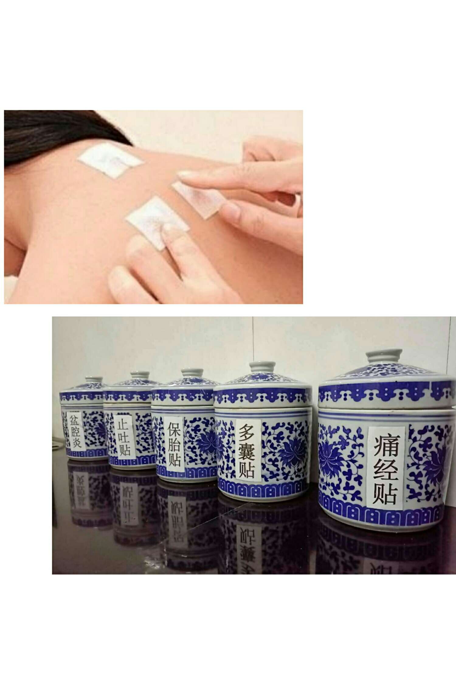 1、三伏貼能治什么??？