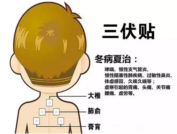 2、三伏貼的功能和功效是什么？