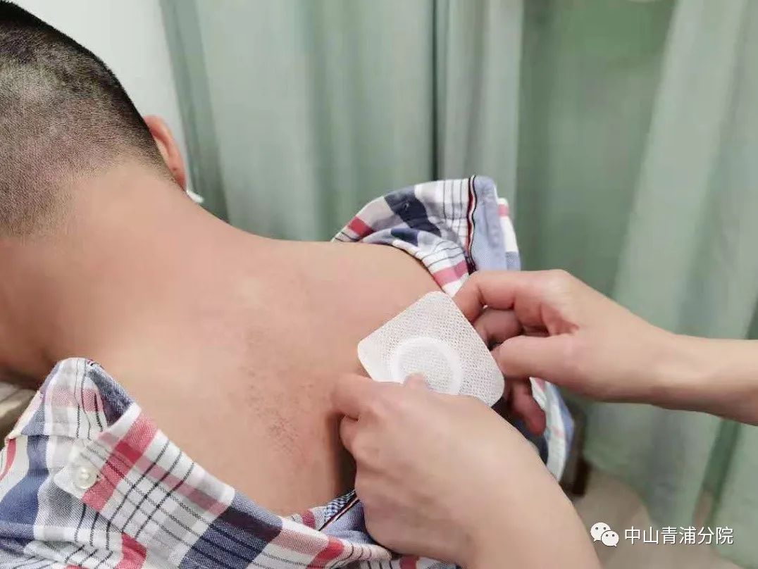 2、江西兒童貼三伏貼癢灼痛，什么體質(zhì)的人可以貼三伏貼癢灼痛？