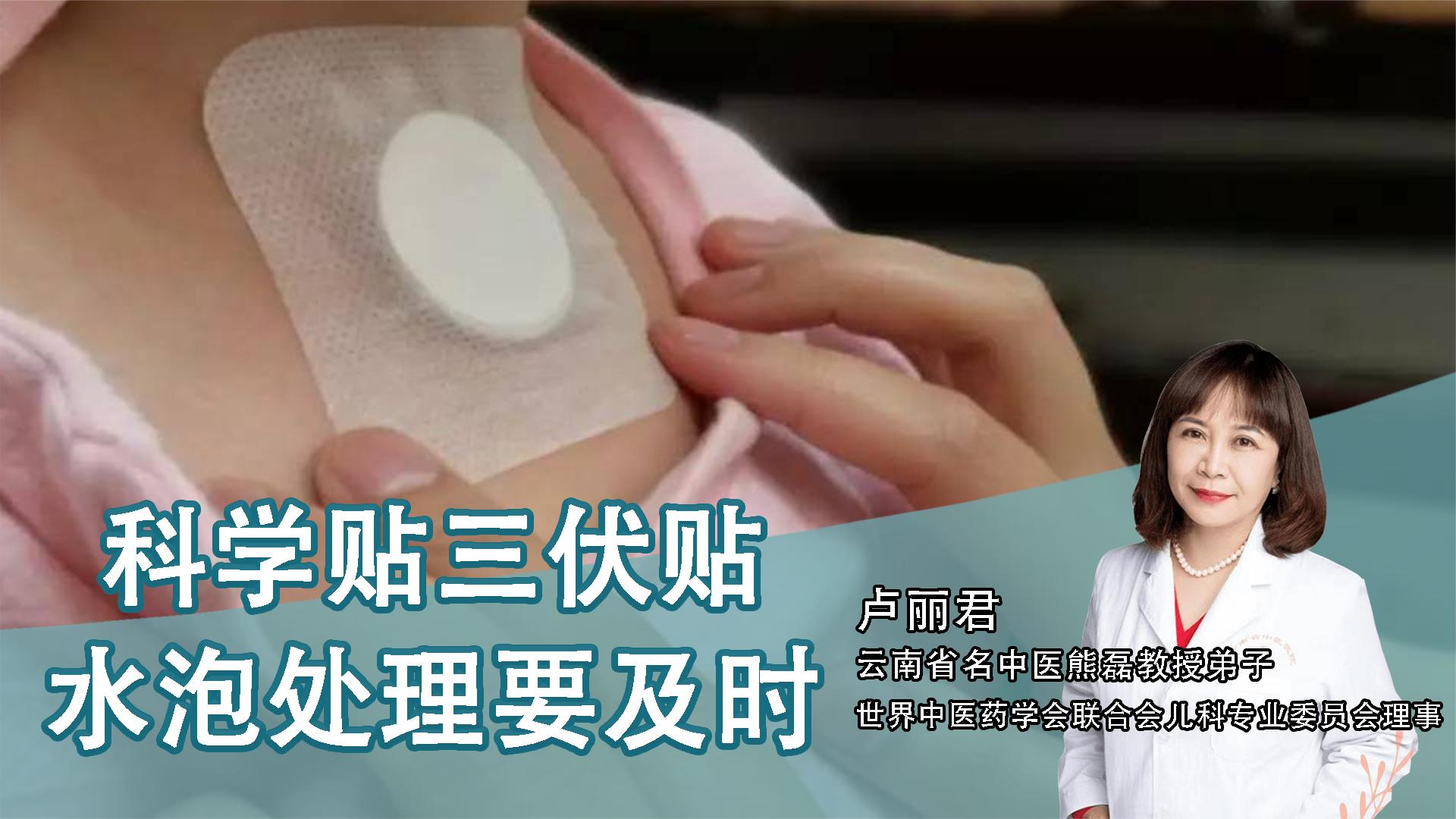 2、貼三伏貼后有什么禁忌？