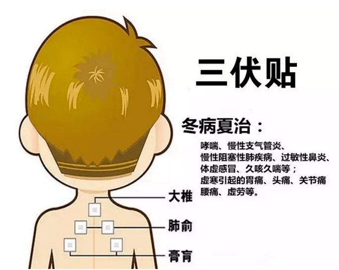 1、三伏貼多大？寶寶能貼多少？</p><p>三伏貼孩子貼多久？