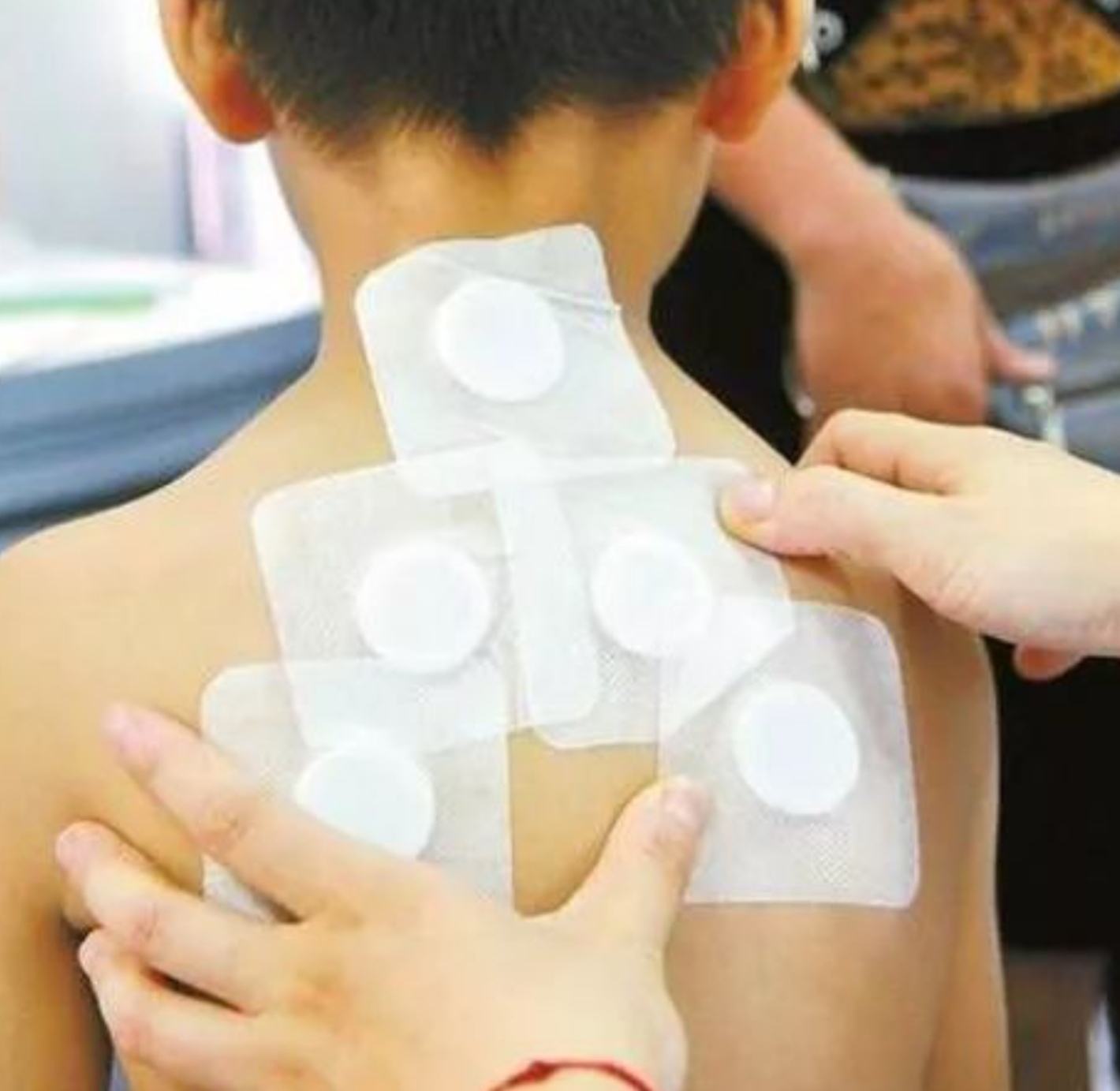 2、三伏貼在脖子上，有一根針，看起來很疼。怎么了